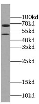 PANK2 Rabbit Polyclonal Antibody