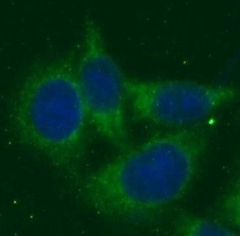 PANK2 Rabbit Polyclonal Antibody