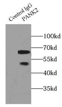 PANK2 Rabbit Polyclonal Antibody