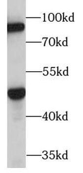 TENT4B Antibody