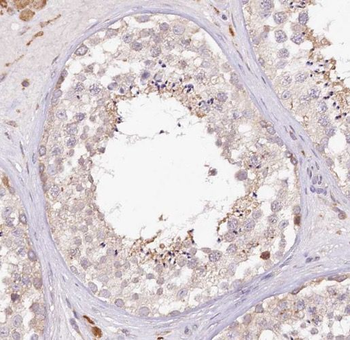 PAPOLG Rabbit Polyclonal Antibody