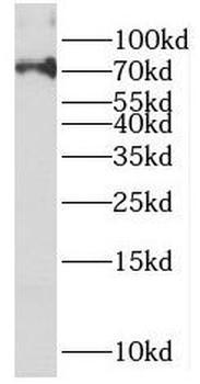 PAPSS2 Antibody