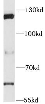 PARP1 Rabbit Polyclonal Antibody