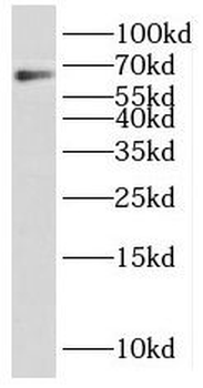 PARP2 Antibody