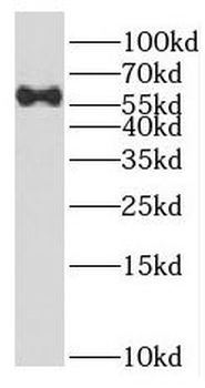 PARP3 Rabbit Polyclonal Antibody