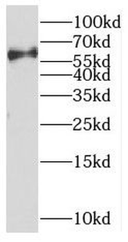 PARP6 Antibody