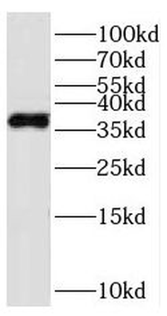 PARVG Rabbit Polyclonal Antibody