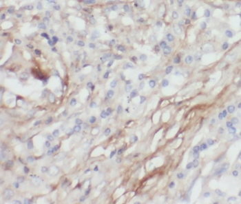 PARVG Rabbit Polyclonal Antibody