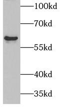 PAX3 Antibody