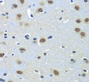 PAX7 Rabbit Polyclonal Antibody