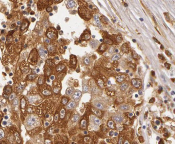 PXN Rabbit Polyclonal Antibody