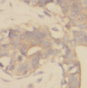 PXN Rabbit Polyclonal Antibody