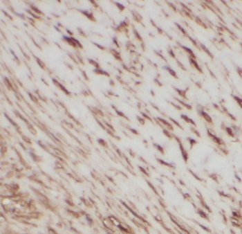 PBK Rabbit Polyclonal Antibody