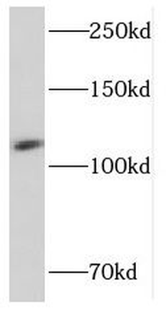 PCDH1 Antibody