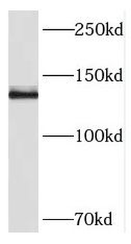 PCDH11X Antibody