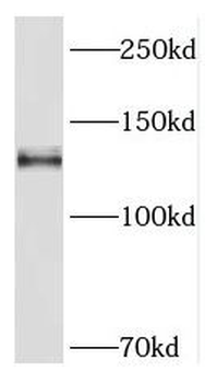 PCDH11Y Antibody