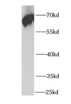 PCK1 Rabbit Polyclonal Antibody