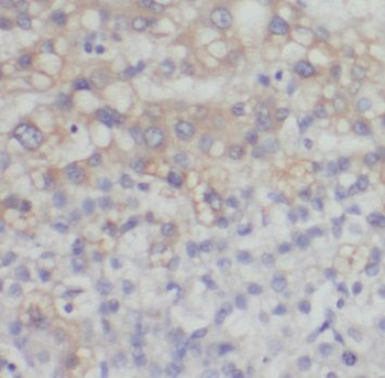 PCK1 Rabbit Polyclonal Antibody