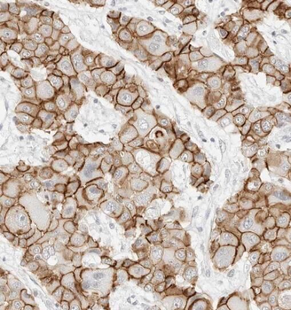 PDCD10 Rabbit Polyclonal Antibody