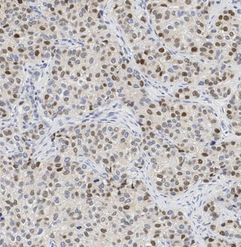PDCD4 Rabbit Polyclonal Antibody