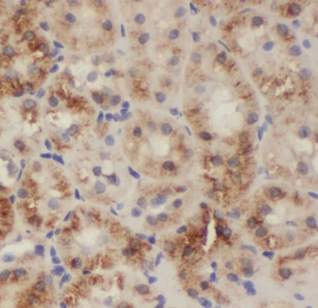 PDCL2 Rabbit Polyclonal Antibody