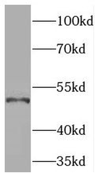 PDE7B Rabbit Polyclonal Antibody