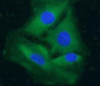 PDE9A Antibody