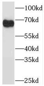 PDLIM5 Antibody