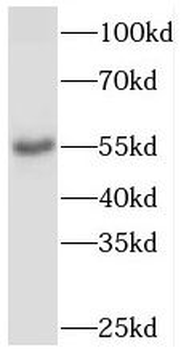 PDLIM7 Antibody