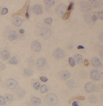 PDP2 Rabbit Polyclonal Antibody