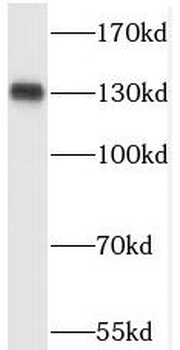 PDS5A Antibody