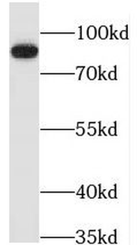 PDXDC1 Rabbit Polyclonal Antibody
