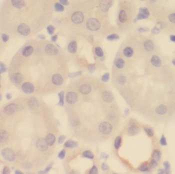 PDXDC1 Rabbit Polyclonal Antibody