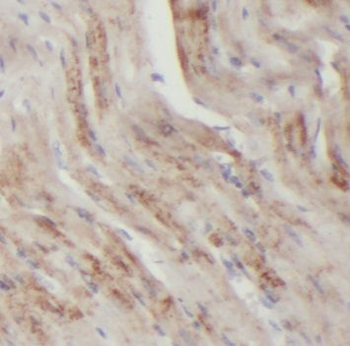 ECI2 Rabbit Polyclonal Antibody
