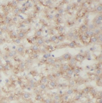 PECR Rabbit Polyclonal Antibody