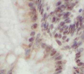 PER3 Rabbit Polyclonal Antibody