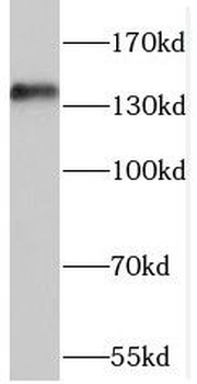 EIF2AK3 Rabbit Polyclonal Antibody