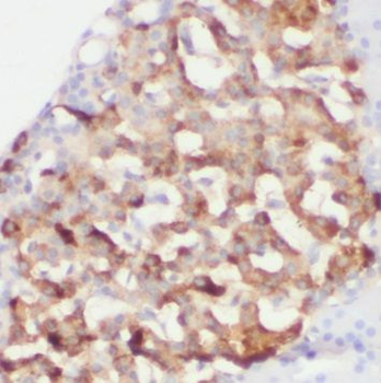 EIF2AK3 Rabbit Polyclonal Antibody