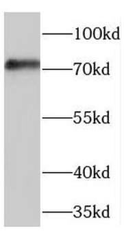 PES1 Antibody