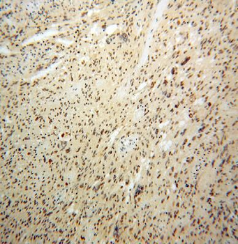 PES1 Rabbit Polyclonal Antibody