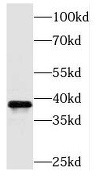 PEX16 Antibody