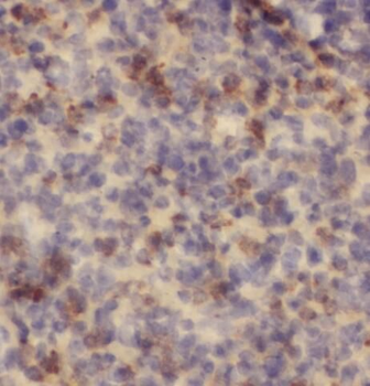 PFKP Rabbit Polyclonal Antibody
