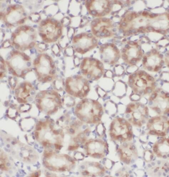 CDK14 Rabbit Polyclonal Antibody