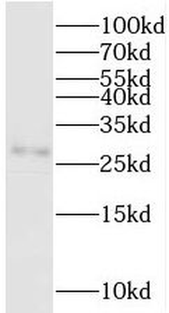 PGAM2 Rabbit Polyclonal Antibody
