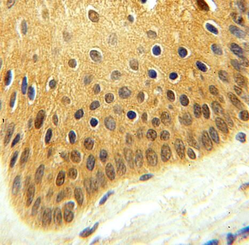 PGAM2 Rabbit Polyclonal Antibody
