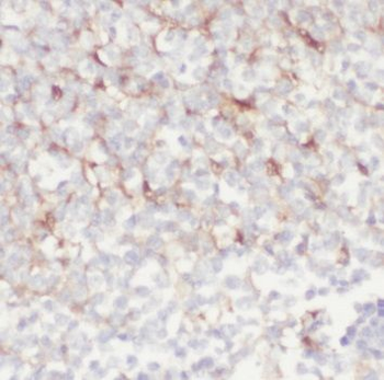 PGLYRP4 Antibody