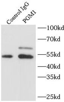 PGM1 Rabbit Polyclonal Antibody