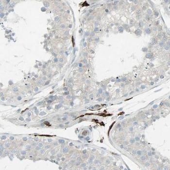 PGM1 Rabbit Polyclonal Antibody