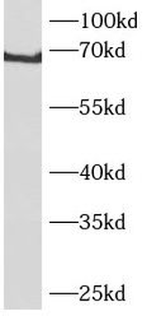 PGM2 Antibody