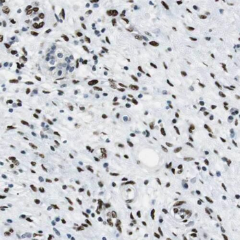 PGM2 Rabbit Polyclonal Antibody
